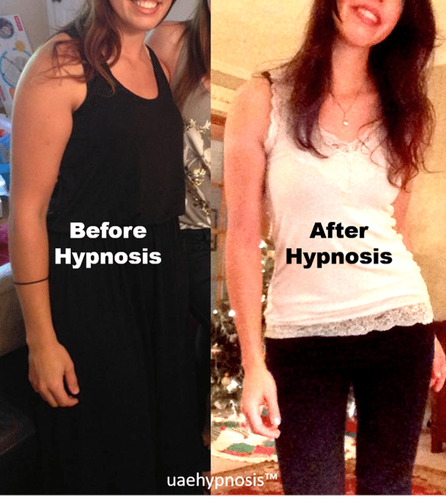 weight loss hypnosis success
